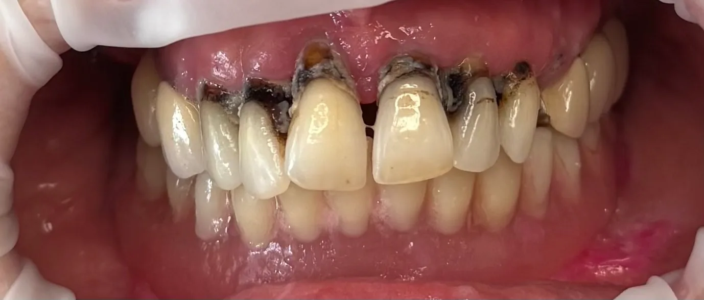 Denteca Smile Clinic Denteca Smile Clinic - stomatologie premium București