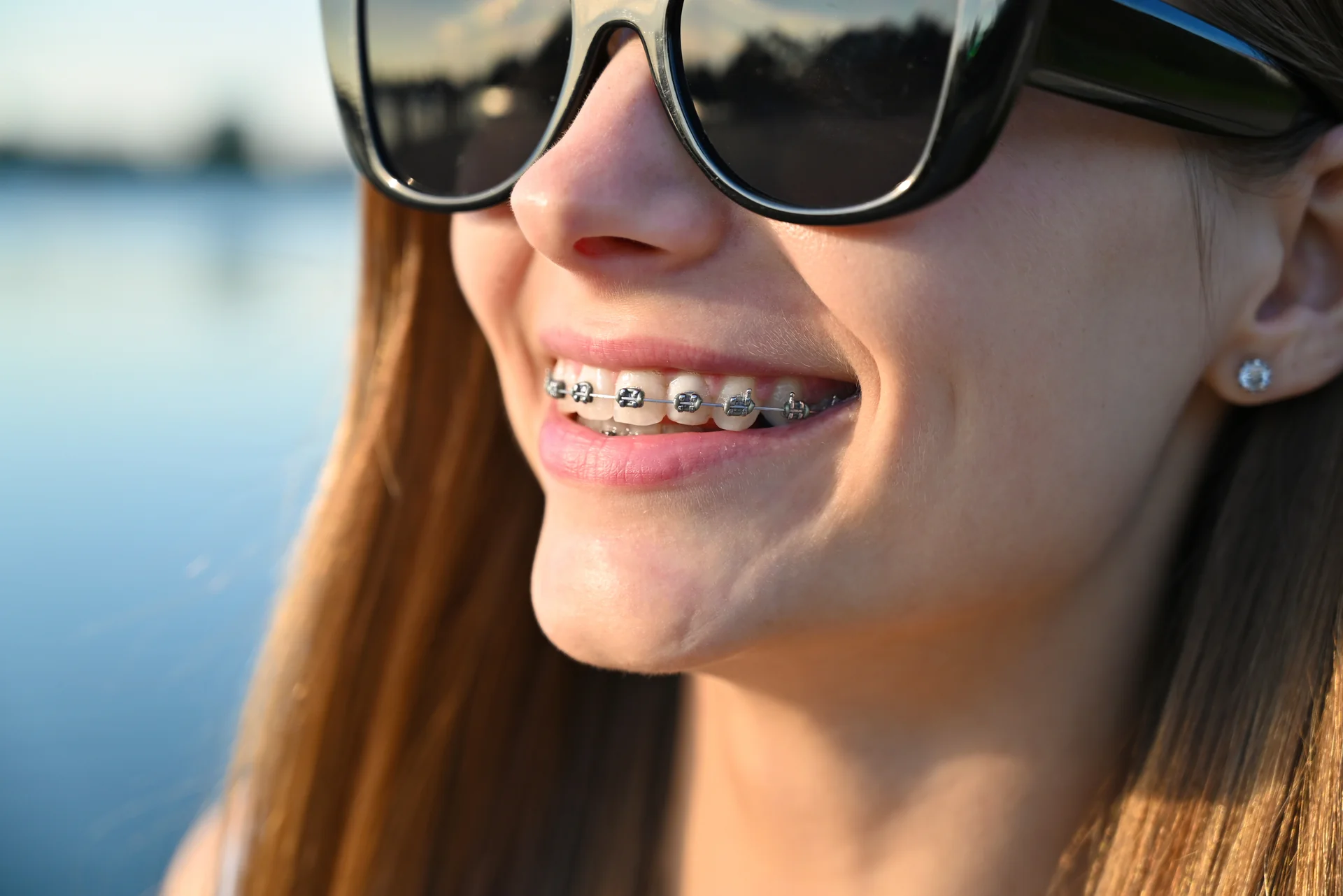 Tratamente ortodontice la adulți: aspecte funcționale și estetice